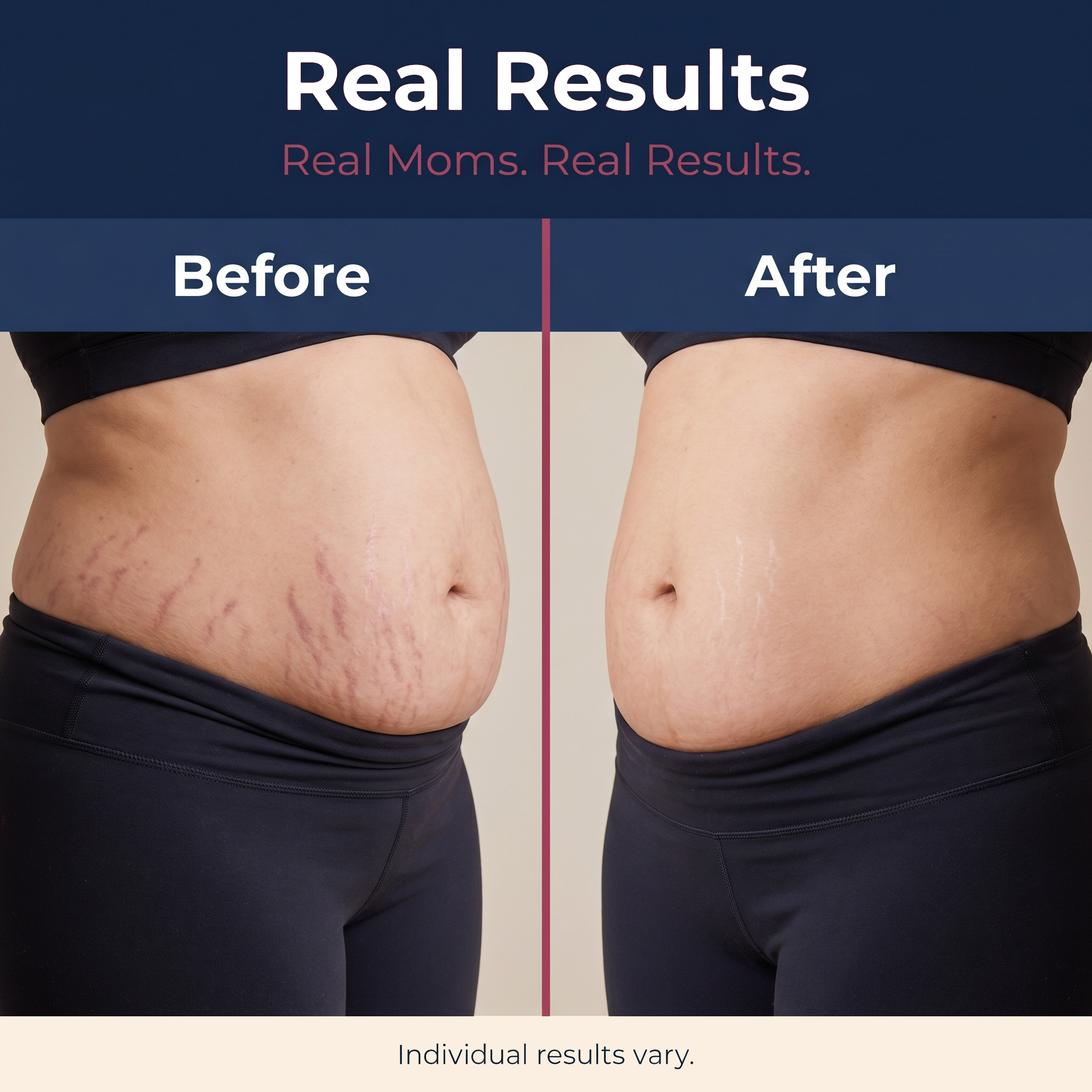 Red Light Belly Wrap